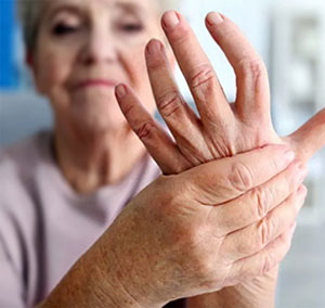 Arthritis and Physiotherapy